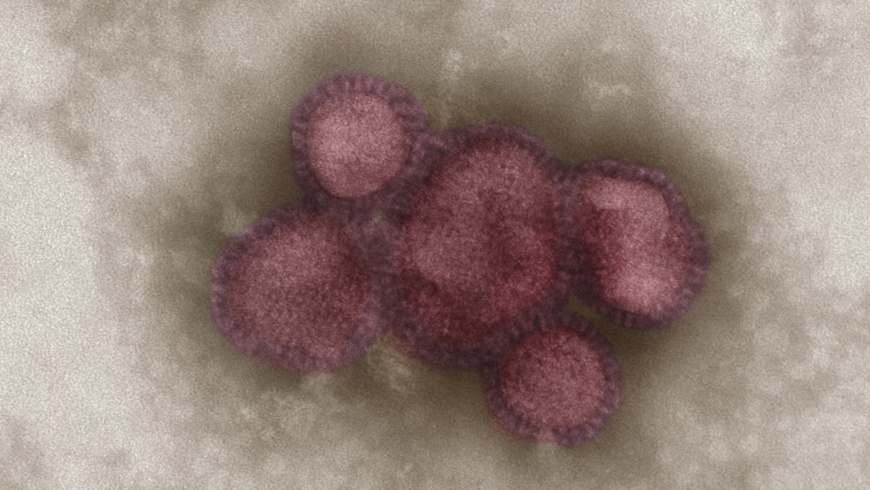 Influenzavirus A/California/7/2009 (H1N1)